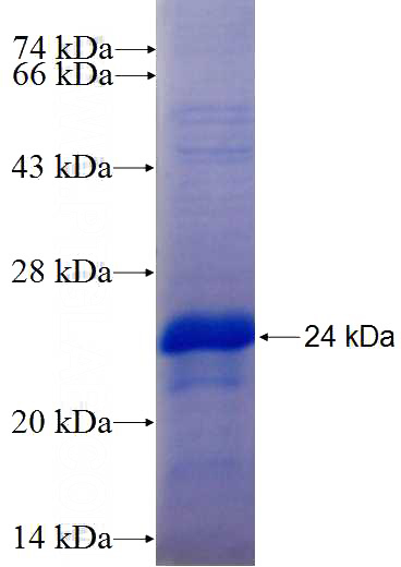 Recombinant Human HOXC13 SDS-PAGE