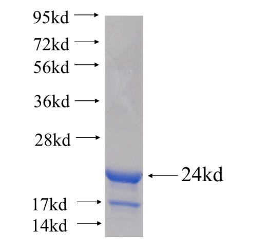 Recombinant human OMA1 SDS-PAGE
