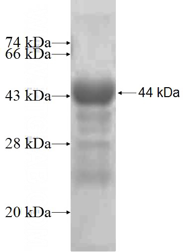 Recombinant Human KARS SDS-PAGE