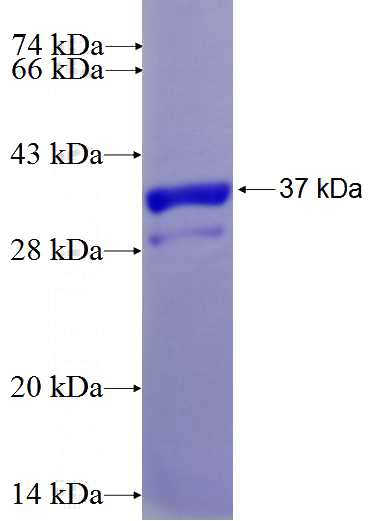 Recombinant Mouse Jph2 SDS-PAGE