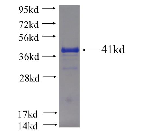 Recombinant human TBC1D24 SDS-PAGE