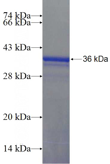 Recombinant Human LIN37 SDS-PAGE