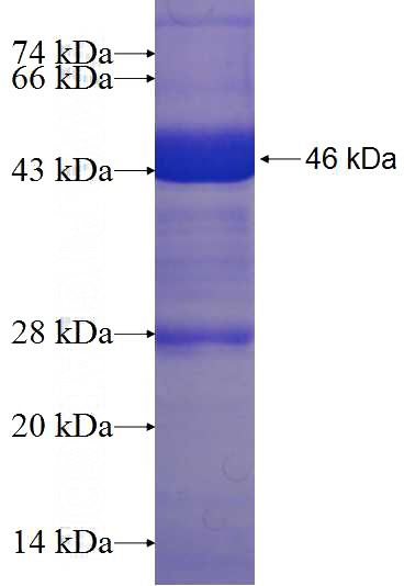 Recombinant Human SMPDL3B SDS-PAGE
