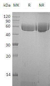 Macaca mulatta AHSG (His tag) recombinant protein