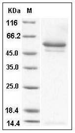 Human SerpinI1 / Neuroserpin Protein (His Tag) SDS-PAGE
