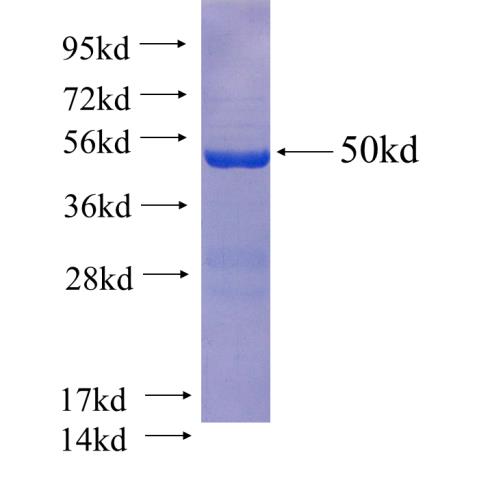 Recombinant human RALA(Full length) SDS-PAGE