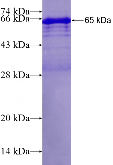 Recombinant Human HDAC2 SDS-PAGE