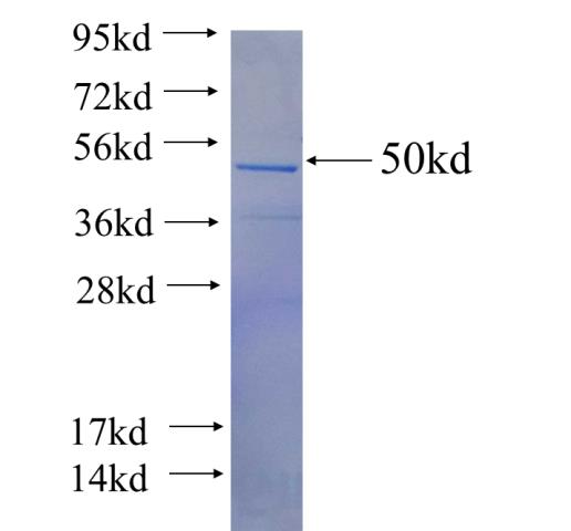 Recombinant human SYCP3 SDS-PAGE