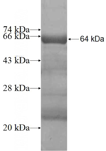 Recombinant Human VILL SDS-PAGE