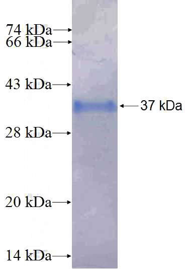 Recombinant Human SLC16A14 SDS-PAGE