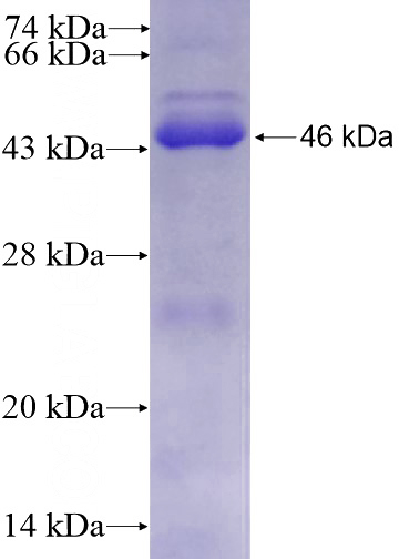 Recombinant Human TIMELESS SDS-PAGE