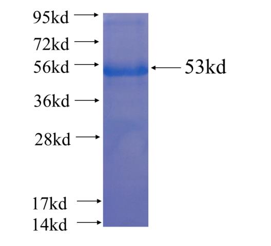 Recombinant human RUVBL2 SDS-PAGE