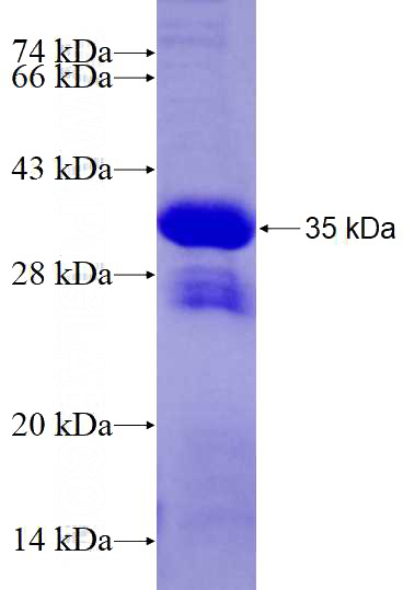 Recombinant Human HLA-F SDS-PAGE