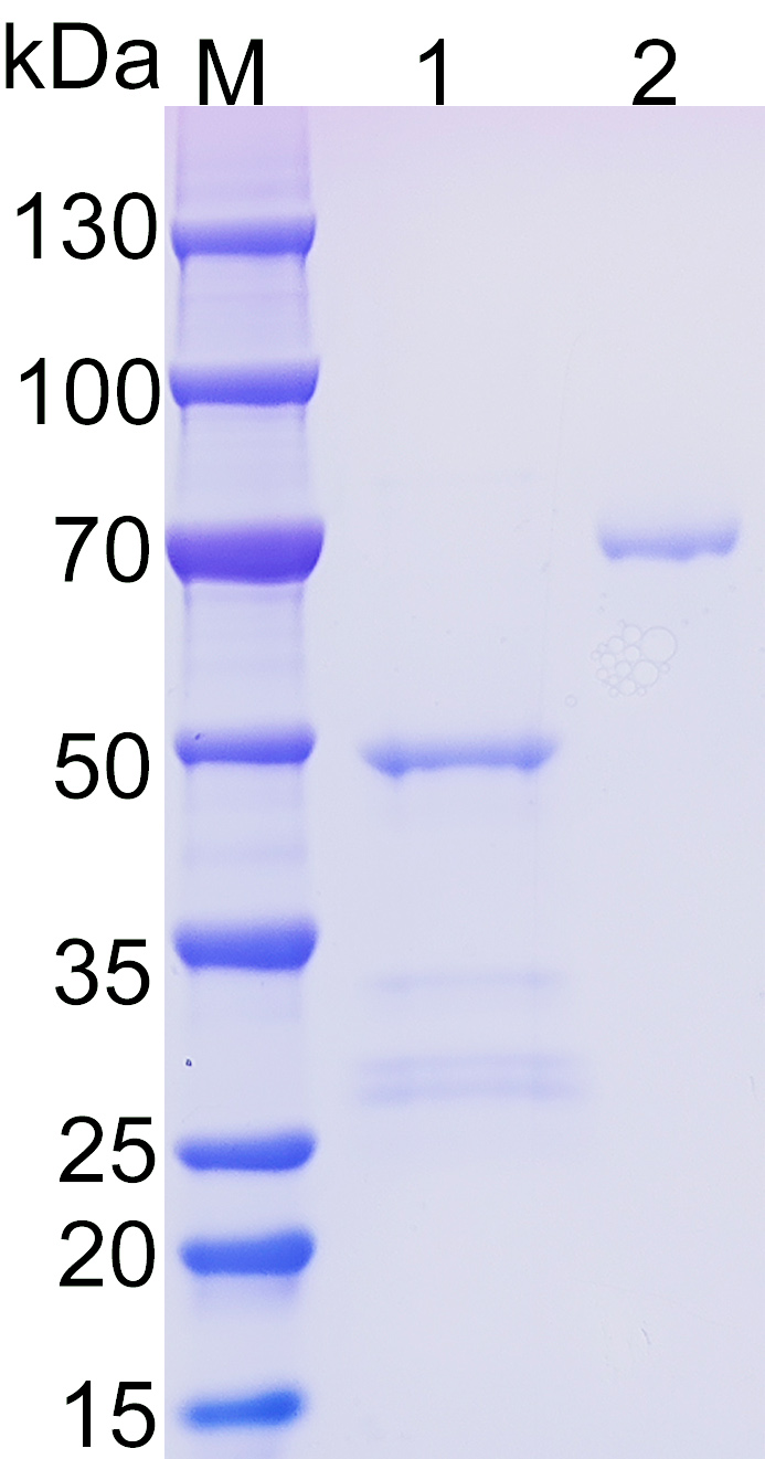 Recombinant human CHCHD2 SDS-PAGE