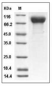 Influenza A H12N5 (A/green-winged teal/ALB/199/1991) Hemagglutinin / HA Protein (His Tag) SDS-PAGE