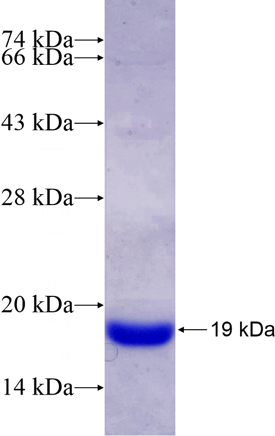 Recombinant Human PVRIG SDS-PAGE