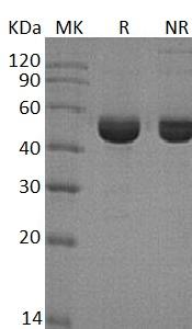 Human SHMT1 (His tag) recombinant protein
