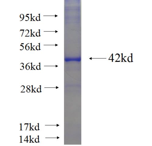 Recombinant human SYCE1 SDS-PAGE