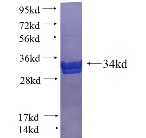 Recombinant human KRT71 SDS-PAGE