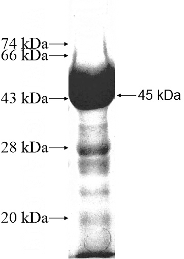 Recombinant Human GBA2 SDS-PAGE