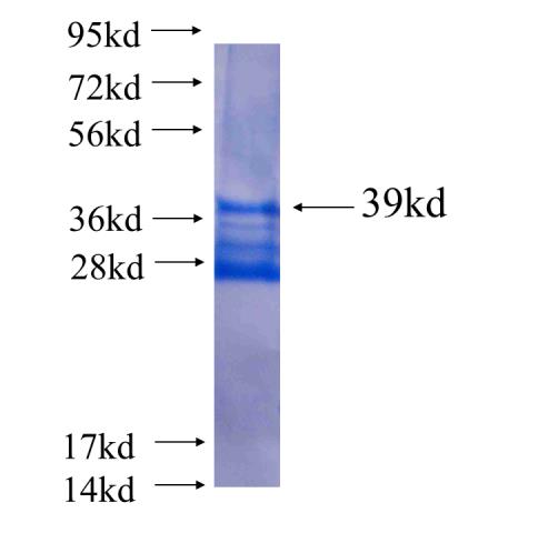 Recombinant human SLC22A15 SDS-PAGE