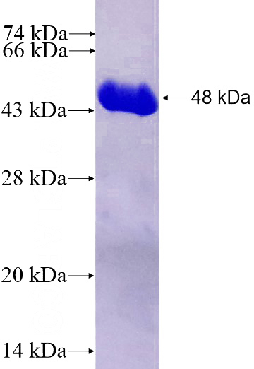 Recombinant Human HOXB9 SDS-PAGE