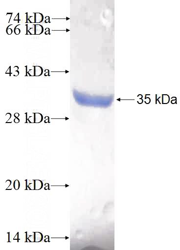 Recombinant Human GEMIN8 SDS-PAGE