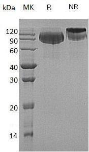 Human BCHE/CHE1 (His tag) recombinant protein