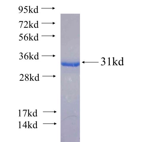 Recombinant human SLC38A5 SDS-PAGE