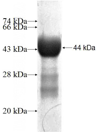 Recombinant Human DNMT3A SDS-PAGE
