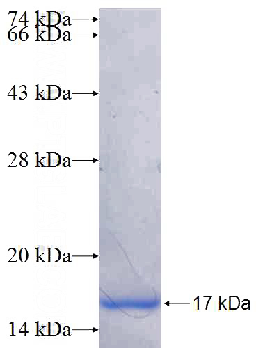 Recombinant Human FLVCR1 SDS-PAGE