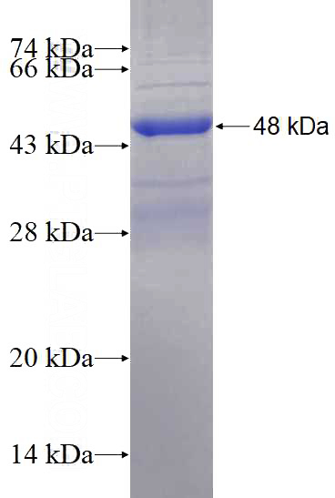 Recombinant Human SLC22A14 SDS-PAGE