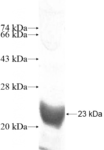 Recombinant Human SLC6A18 SDS-PAGE