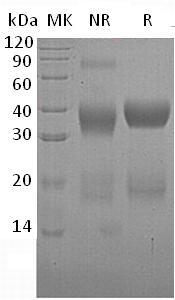 Human VSTM2A/VSTM2 (His tag) recombinant protein