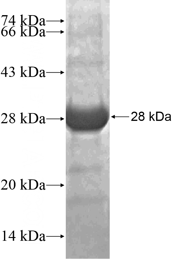 Recombinant Human BICD1 SDS-PAGE