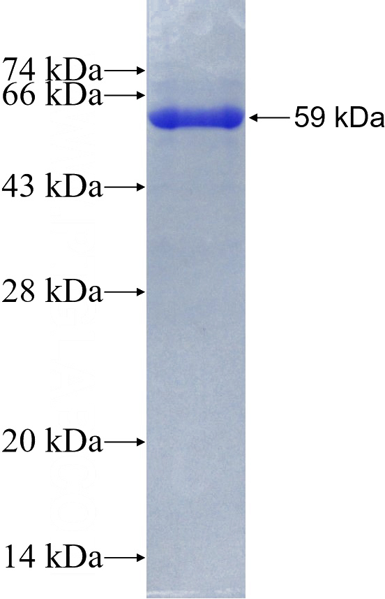 Recombinant Human CCT3 SDS-PAGE