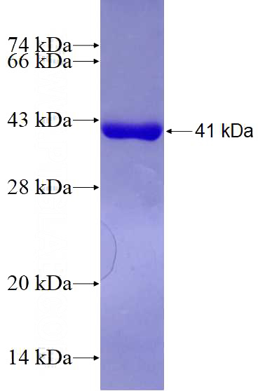 Recombinant Human NSF SDS-PAGE