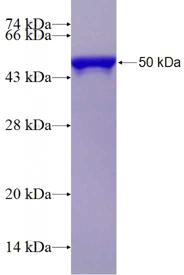 Recombinant Human MYH9 SDS-PAGE