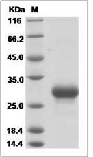Mouse PTGDS / L-PGDS Protein (His Tag)