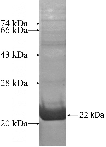 Recombinant Human HDDC3 SDS-PAGE