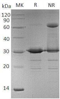 Mouse Adipoq/Acdc/Acrp30/Apm1 (His tag) recombinant protein