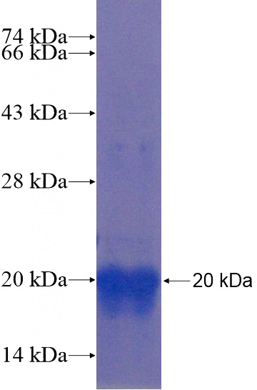 Recombinant Human MATN3 SDS-PAGE