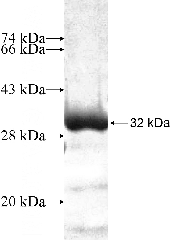 Recombinant Human PPARD SDS-PAGE