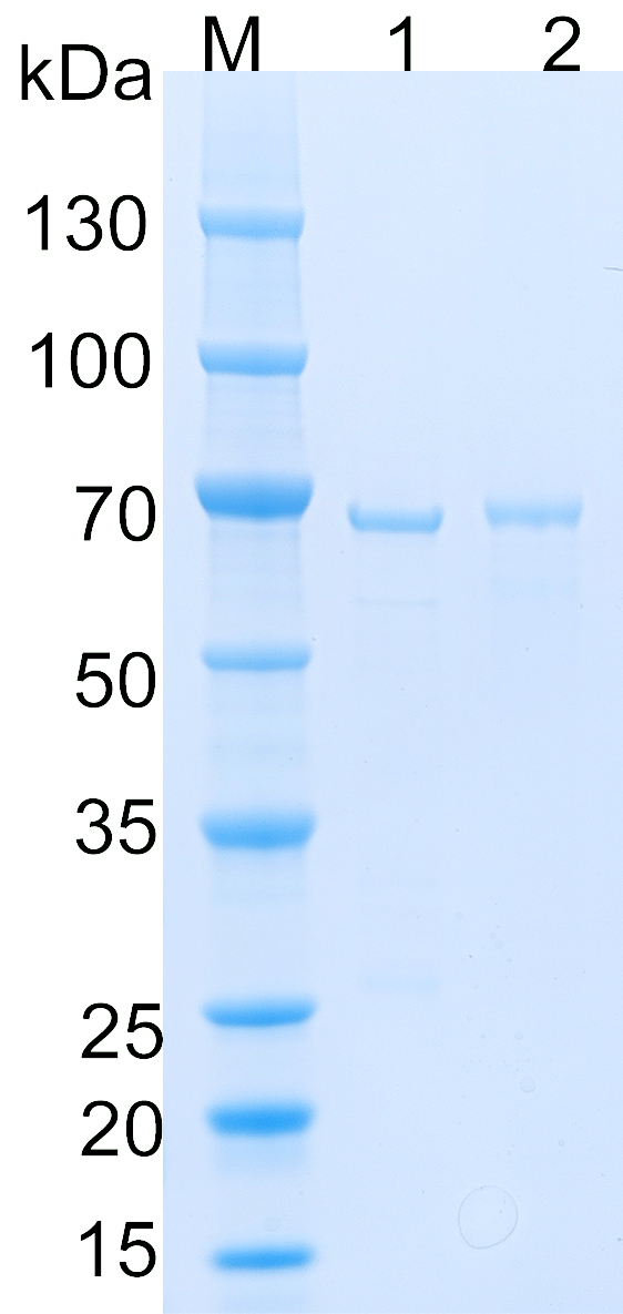 Recombinant Human DLAT SDS-PAGE