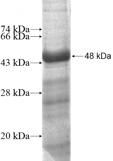 Recombinant Human ARPC1A SDS-PAGE