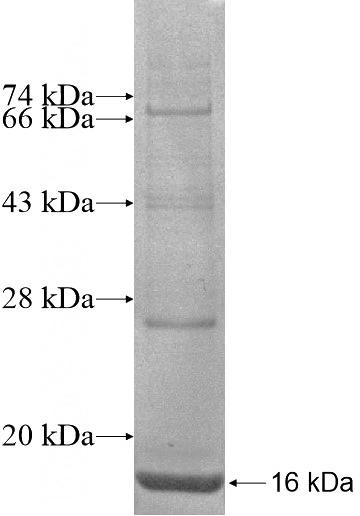Recombinant Human MC3R SDS-PAGE