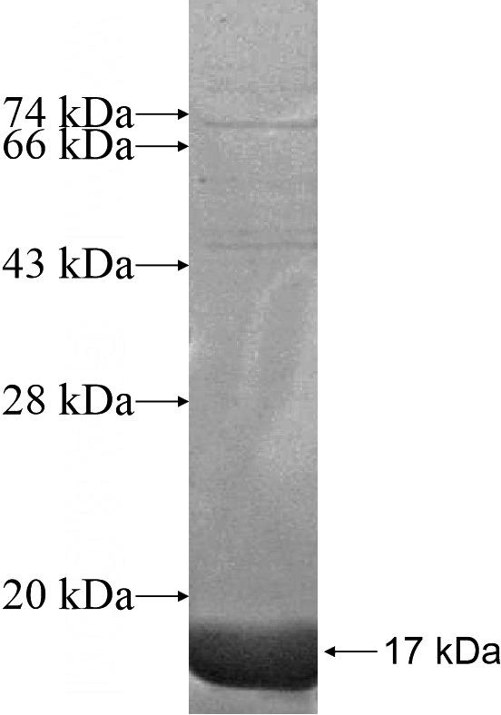 Recombinant Human GABRA6 SDS-PAGE