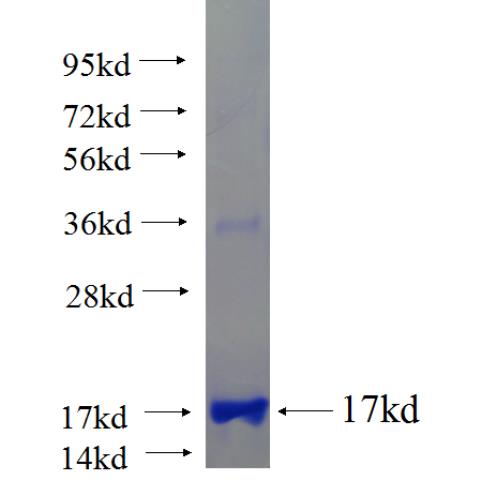 Recombinant human TNNI2 SDS-PAGE