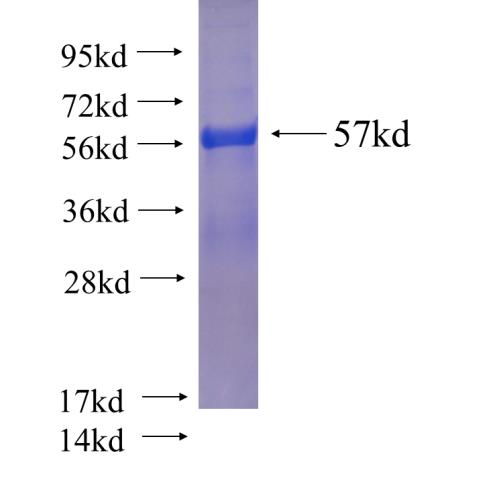 Recombinant human ZWINT SDS-PAGE