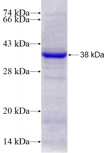Recombinant Human GAB1 SDS-PAGE